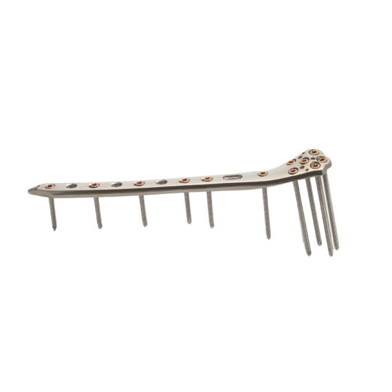 fémur distal loqteq 4.5