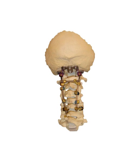 altius columna cervical