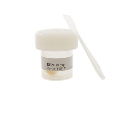 dbm (demineralized bone matrix)