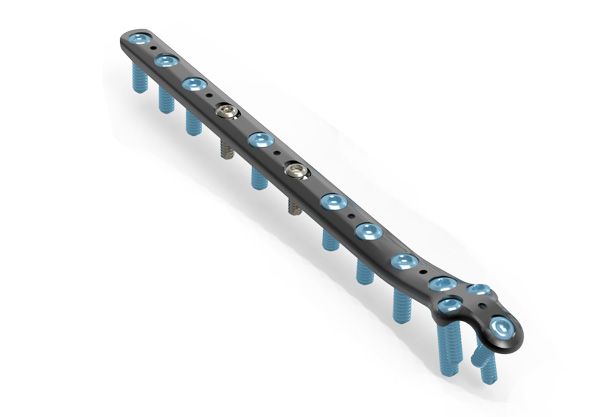 sistema modular de pie