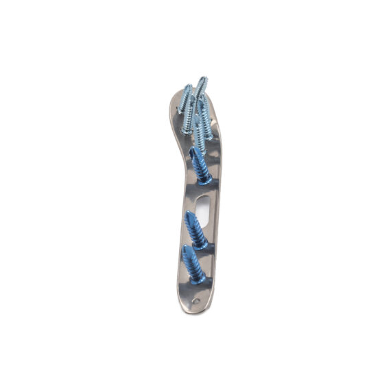 placa para fibula distal loqteq® 3.5 mm