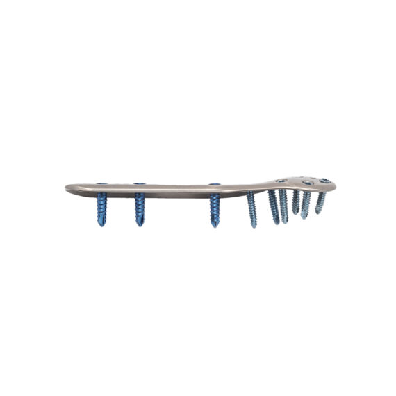 placa para fibula distal loqteq® 3.5 mm