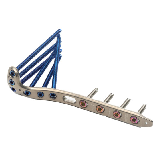 tibia proximal loqteq® 4.5 mm