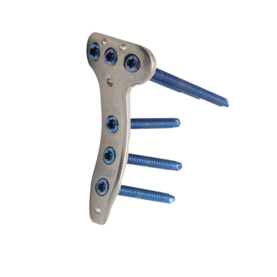 placa para tibia proximal medial loqteq® 3.5 mm
