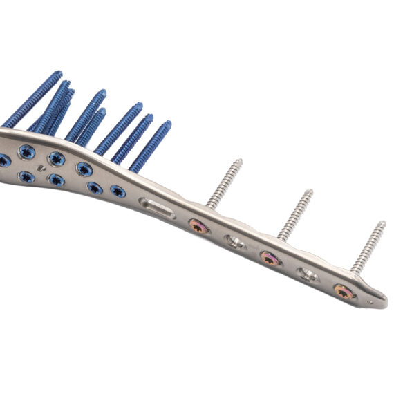 placa tibia distal