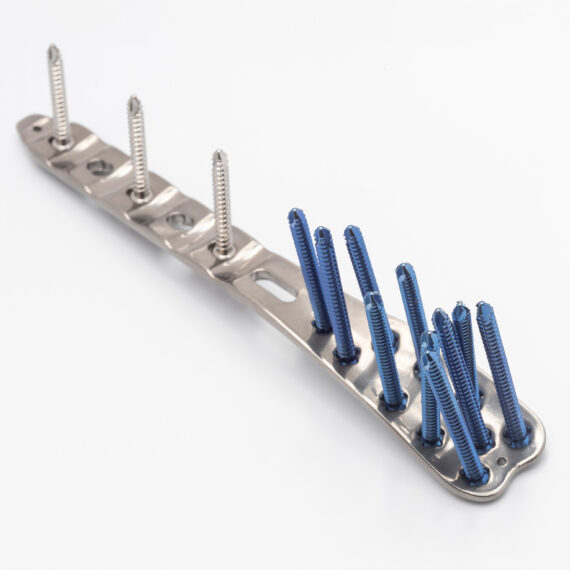 placa tibia distal